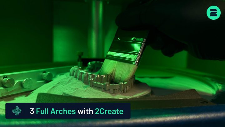 Couverture vidéo : Impression de 3 implants dentaires à arcade complète en seulement 3 heures