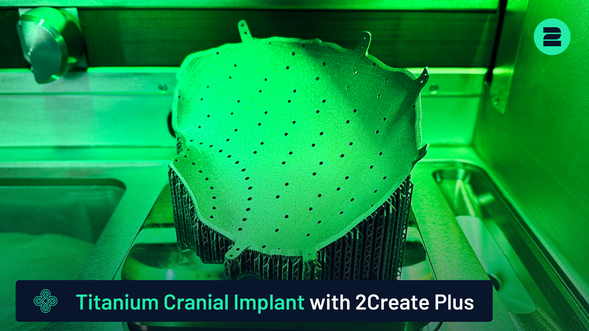 Titanium Cranial Implant