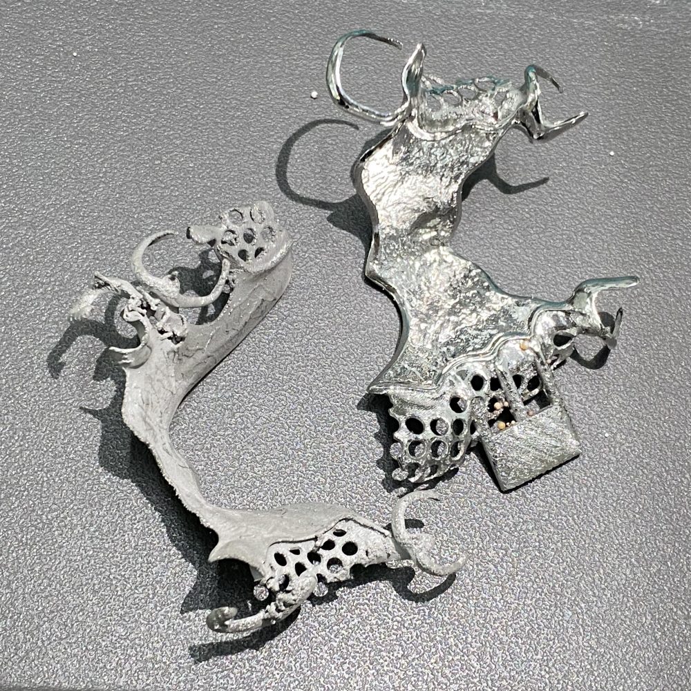 3D printed partials by 2onelab