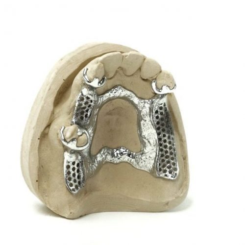 3D printed RPD (CoCr) by 2onelab