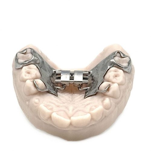 3D printed RPE (Stainless Steel) by 2onelab