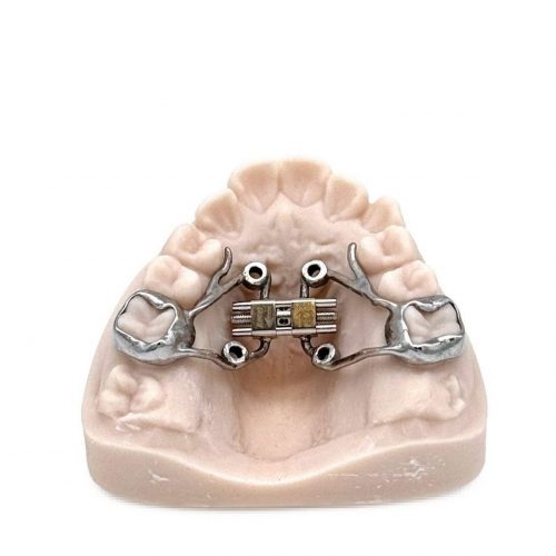 3D printed RPE (Stainless Steel) by 2onelab