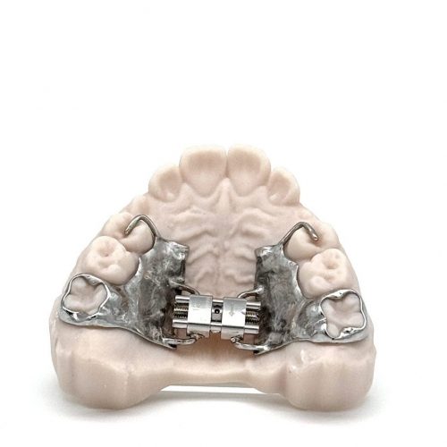 3D printed RPE (Stainless Steel) by 2onelab