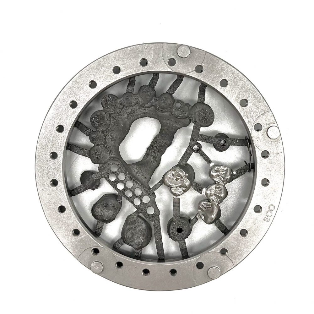 3D printed dental crowns and partial telescope (CoCr)