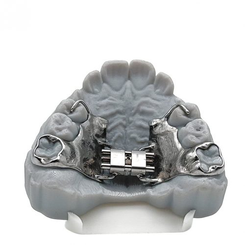 orthoband application on model