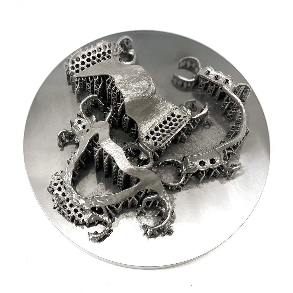 3D printed partials (CoCr) by 2onelab