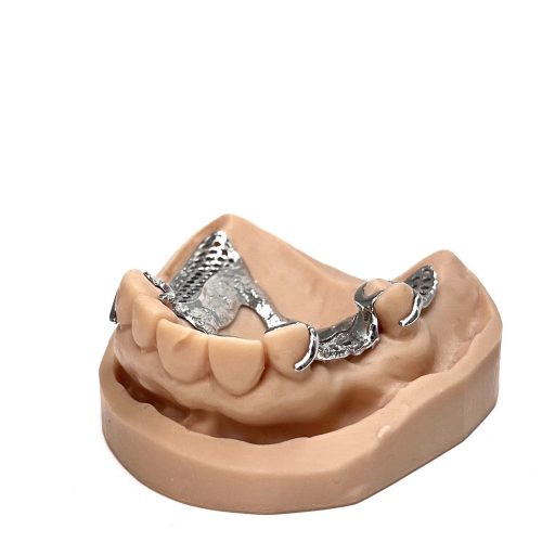 3D printed partial (CoCr) by 2onelab