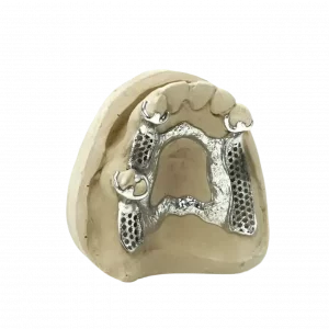 3D printed partial (CoCr) by 2onelab