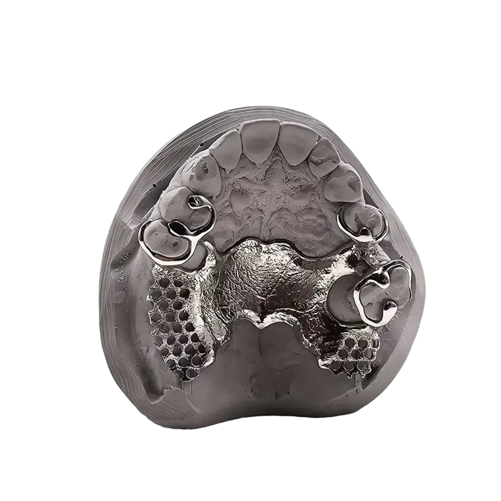 3D printed partial (CoCr) by 2onelab