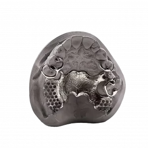 3D printed partial (CoCr) by 2onelab
