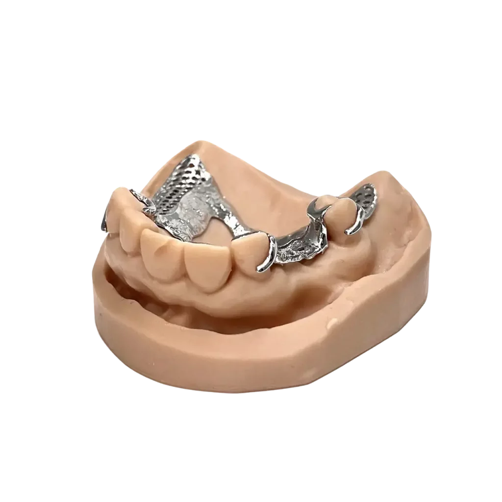 3D printed partial (CoCr) by 2onelab