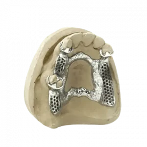 3D printed partial (CoCr) by 2onelab