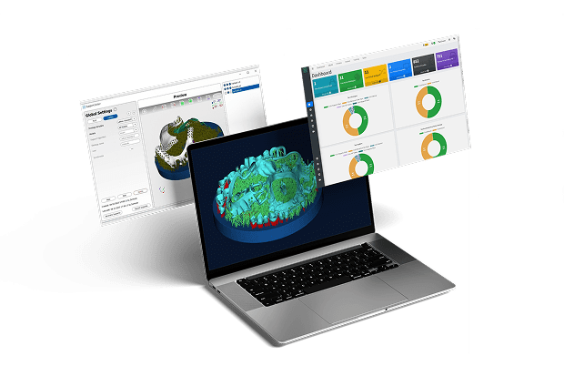 3D Metal Printing Software by 2onelab