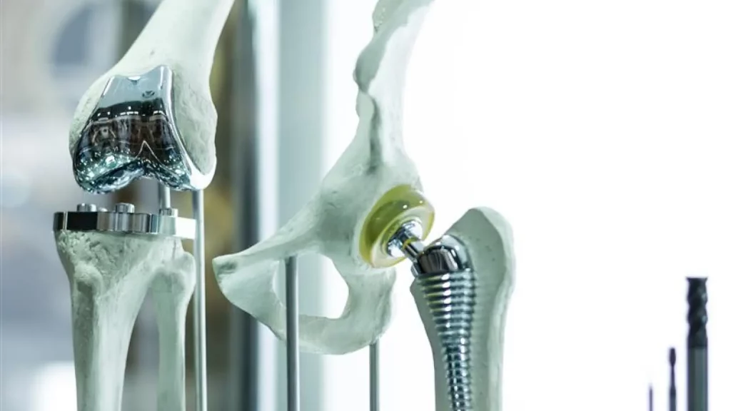 Knee and Hip Implant