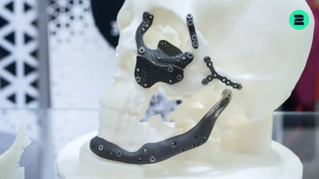 The Role of 3D-Printed Titanium Implants in Modern Healthcare