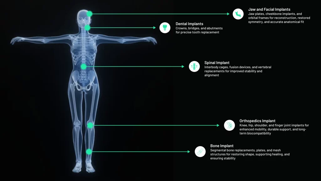 Graphic illustrating main medical fields for titanium implant applications, including dental, orthopedic, cranial, and spinal implants