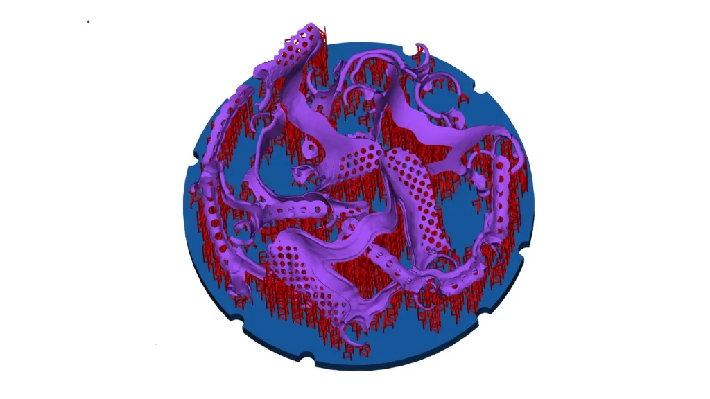 3D printed RPD frameworks with 2Create Desktop