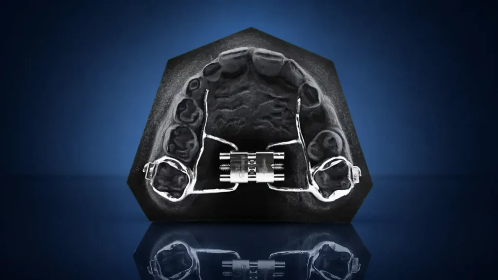 3d printing in orthodontics