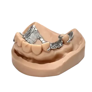 Metal Partial Denture (RPD) in CoCr