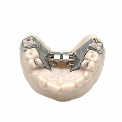 3D printed RPE (Stainless Steel) by 2onelab