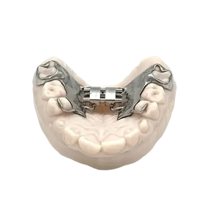 3D printed RPE (Stainless Steel) by 2onelab